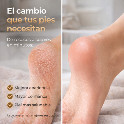 Removedor de Callos Eléctrico Recargable 25 Piezas | Pedicure Profesional en Casa LCD