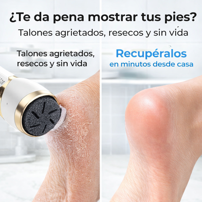 Removedor de Callos Eléctrico Recargable 25 Piezas | Pedicure Profesional en Casa LCD